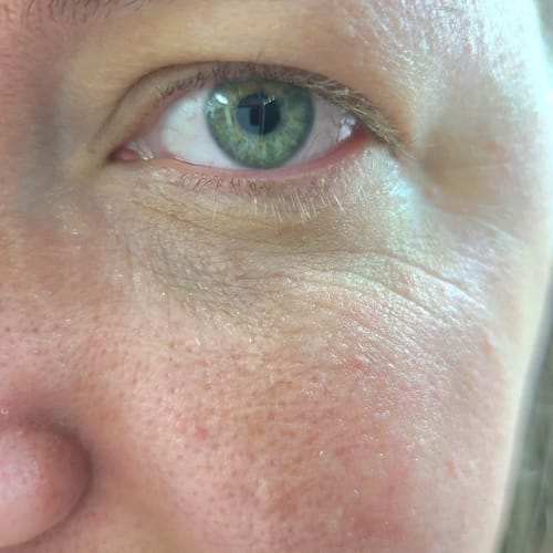 Customer photo review of Luminous Face Lift Bundle - Sale