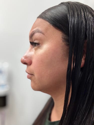 Customer photo review of Mouth Tape