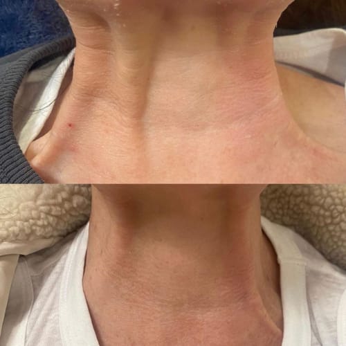 Customer photo review of Luminous Face Lift Bundle - Sale