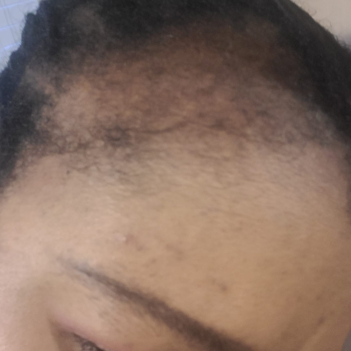 Customer photo review of 100% Natural Hair Growth / Thickening Oil