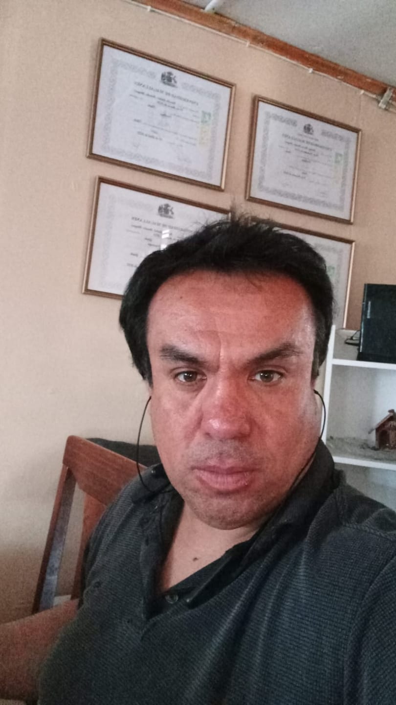 Customer photo review of Pack Anticaída de Cabello para 3 Meses