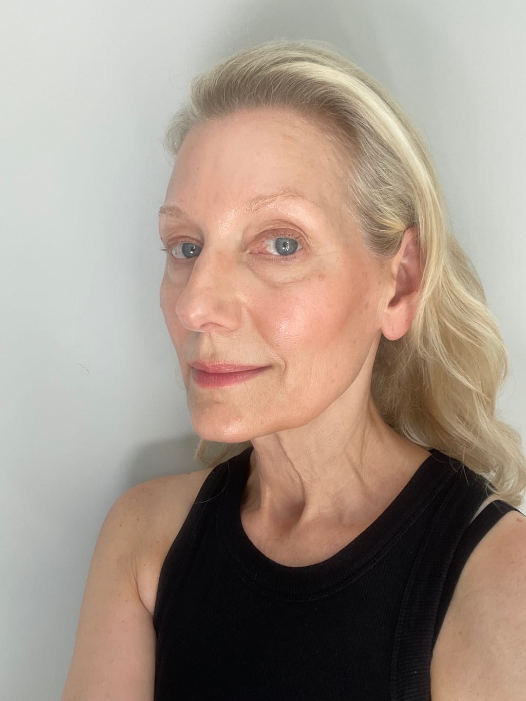 Customer photo review of dr.NC CONCENTRATED CLARIFIER 18% AHAs + BHA - 30ML