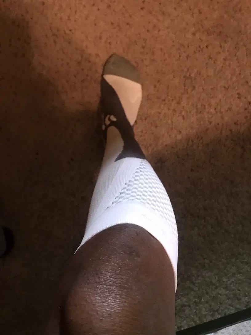 Customer photo review of Armadilo Heavy-Duty Compression Socks