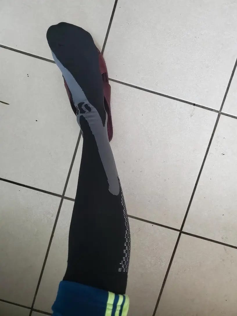 Customer photo review of Armadilo Heavy-Duty Compression Socks