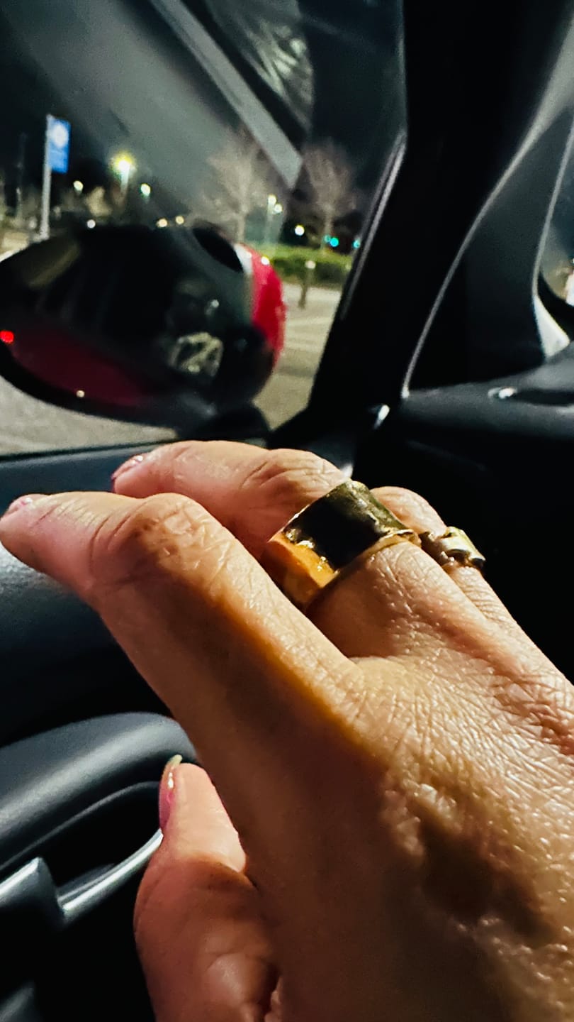 Customer photo review of Textured Band Ring