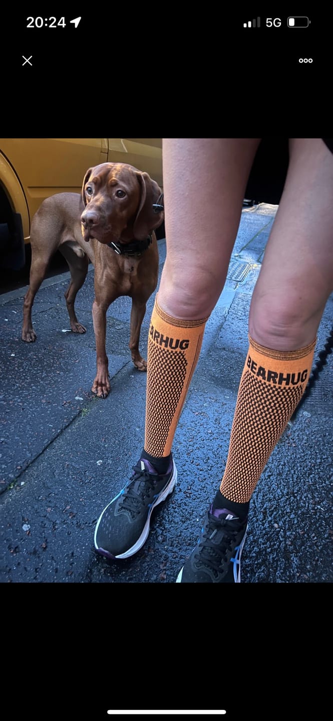 Customer photo review of Calf Compression Support Sleeve For Shin Splint Pain Relief