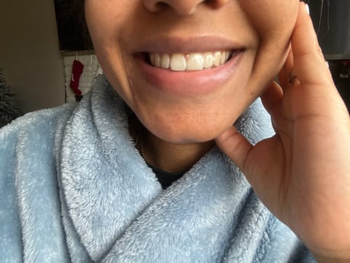 Customer photo review of Premium Upper Retainer