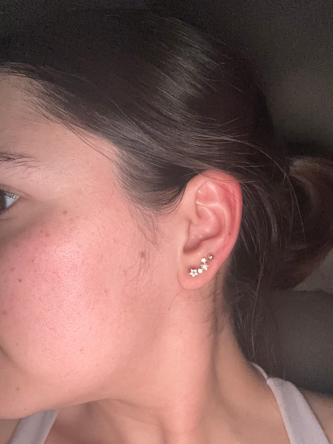 Customer photo review of Acero Quirúrgico Dorado Con Zirconias Primera Perforación