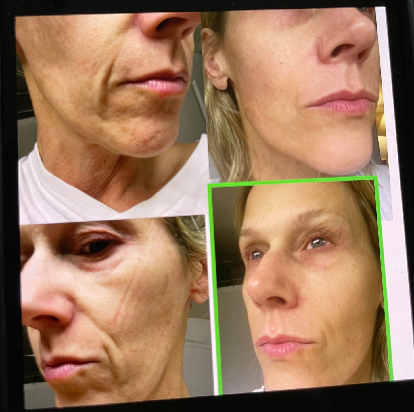 Customer photo review of Anti-Aging treatment