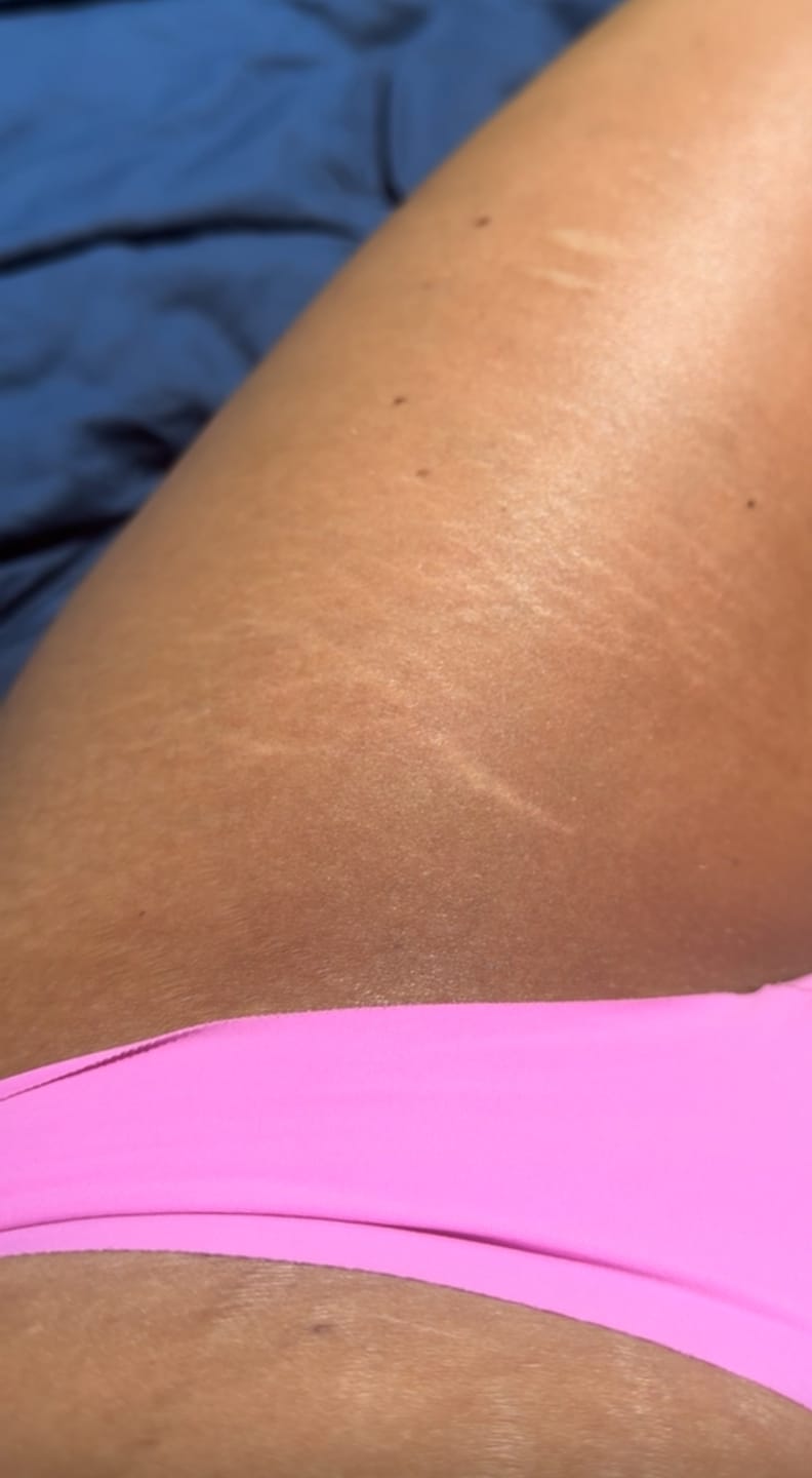 Customer photo review of Prestige Tans: Tanning Nasal Spray