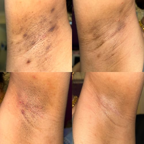 Customer photo review of Turmeric Glow Soap