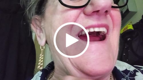 Customer video review of (4 FOR 3 DEAL) Venneir® Anti-stain, Alcohol-Free Mouthwash for Veneers, Implants, Bonding & Crowns