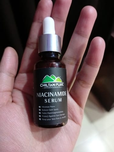 Customer photo review of Niacinamide Serum - Strengthens Skin's Barrier & Boosts Skin's Immunity