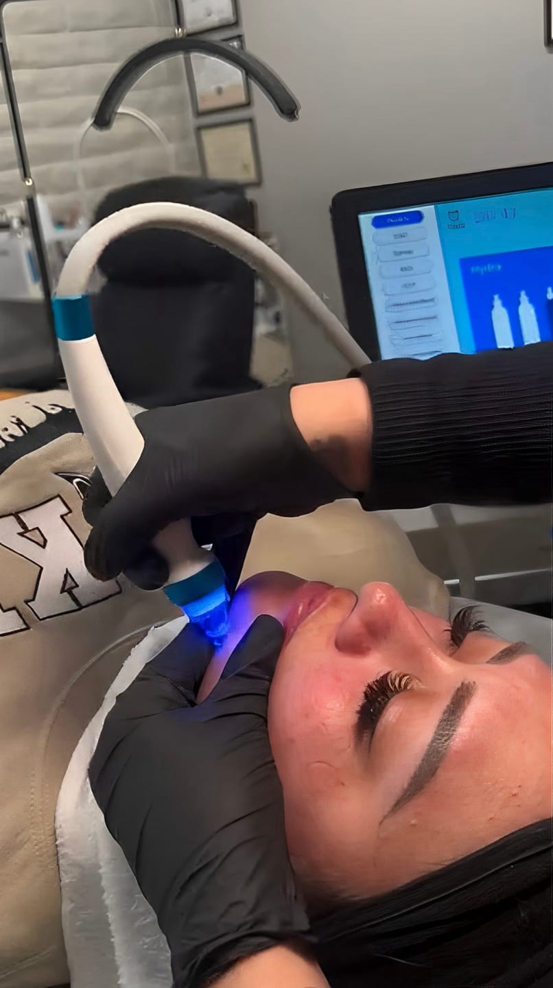 Customer photo review of Hydra Dermabrasion Facial Machine Professional
