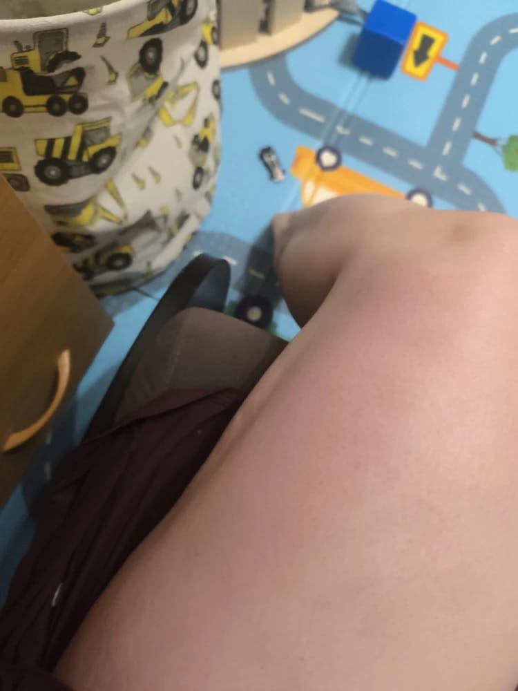 Customer photo review of Revimus Anti-Cellulite Massager