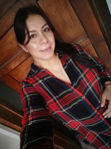 Customer photo review of NUEVO: Kit Piel Deslumbrante (47% OFF) - Limpiador + Tónico + Serum Vitamina C + Serum Niacinamida + Serum Ácido Glicólico + Serum Ácido Hialurónico + Contorno de Ojos