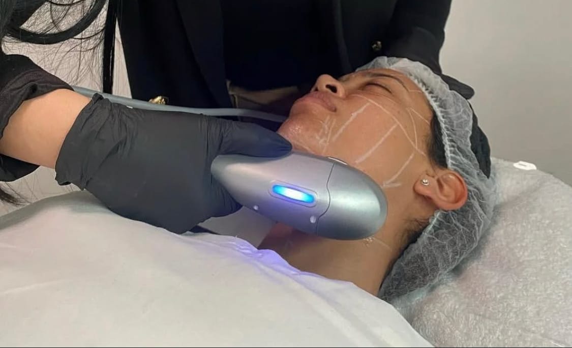 Customer photo review of 7D HIFU Machine Elite