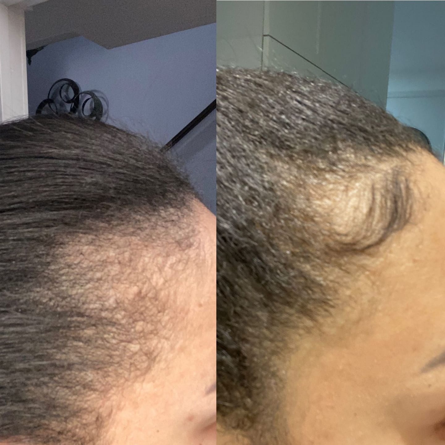 Customer photo review of Healthy Hair Vitamins