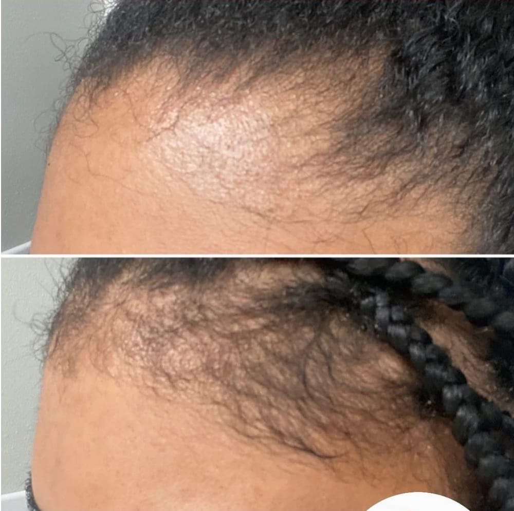 Customer photo review of Healthy Hair Vitamins