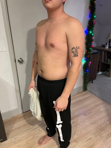 Customer photo review of Semaglutide Weight Loss Program