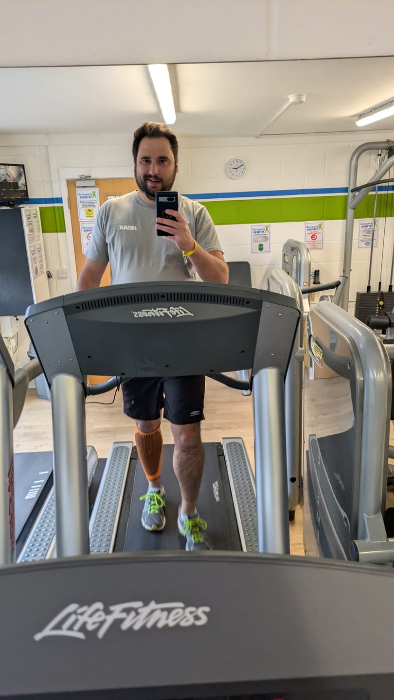 Customer photo review of Calf Compression Support Sleeve For Shin Splint Pain Relief