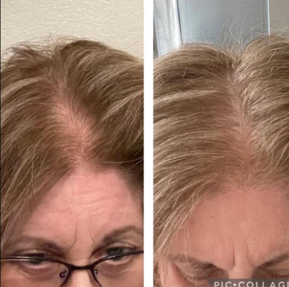 Customer photo review of Healthy Hair Vitamins