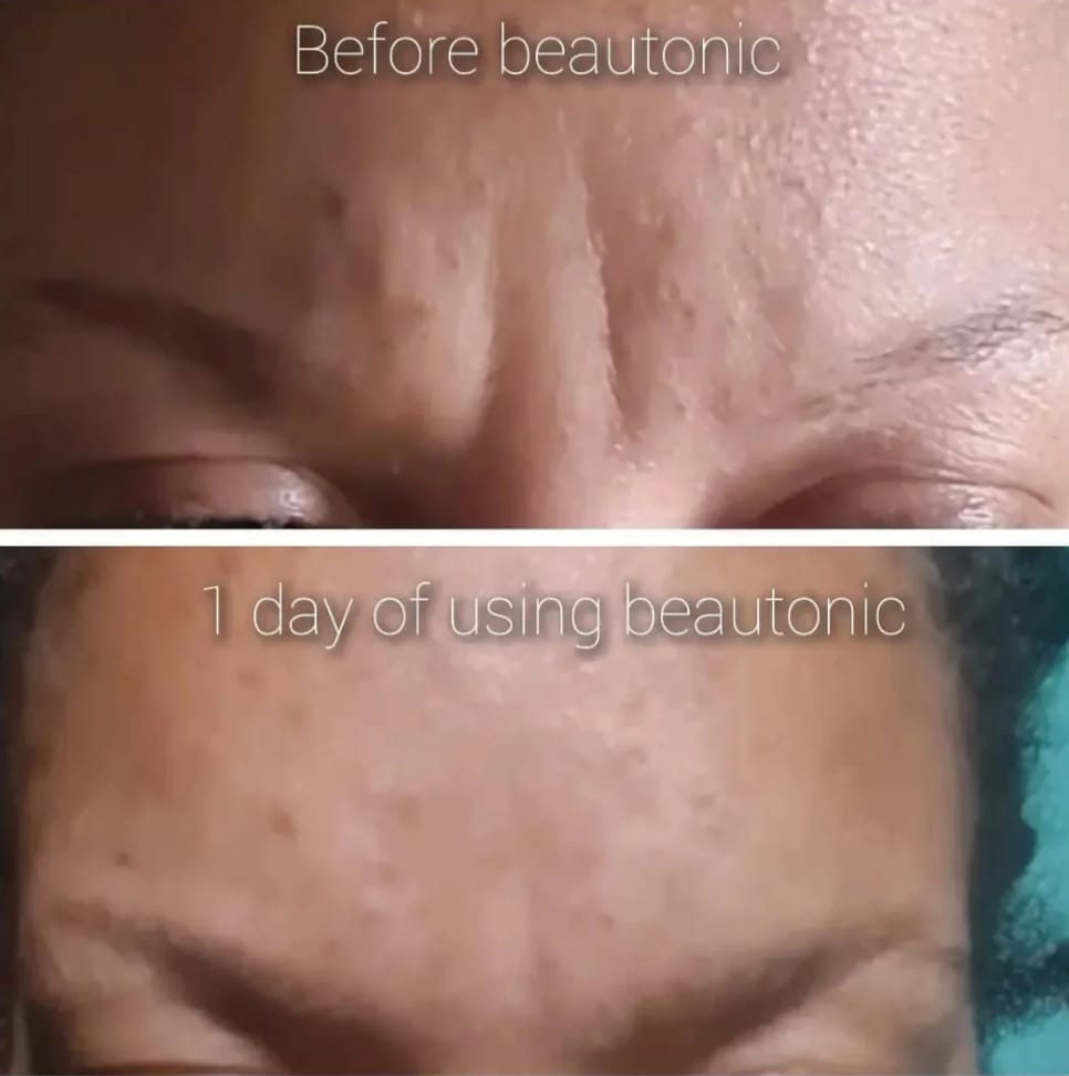Customer photo review of Healthy Hair Vitamins
