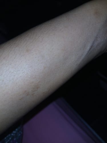 Customer photo review of Anti-Acne & Dark Spots African Soap