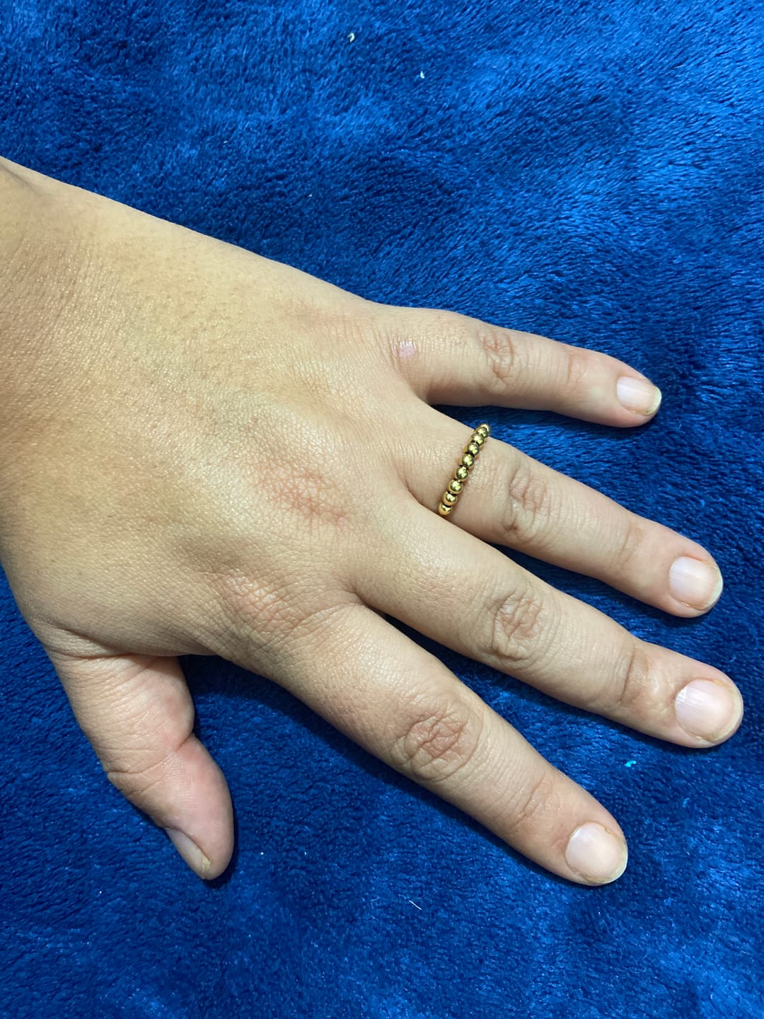 Customer photo review of Anillo Anti-Ansiedad