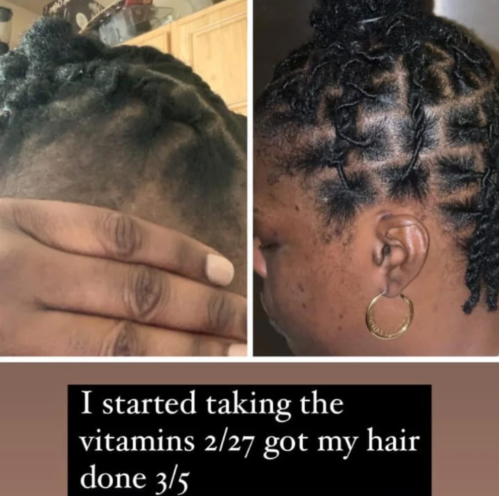 Customer photo review of Healthy Hair Vitamins