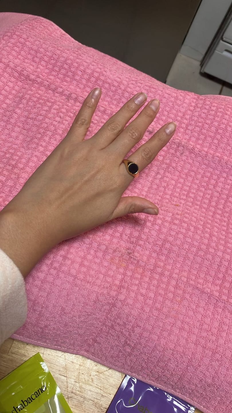 Customer photo review of Anillo Ajustable Neuss