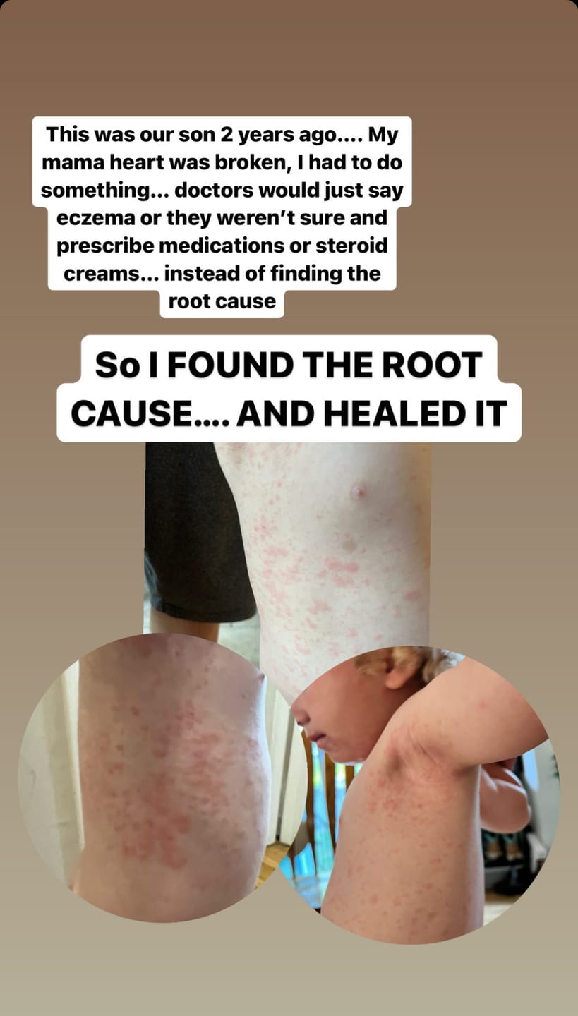 Customer photo review of Children’s Gut Rebalance Kit