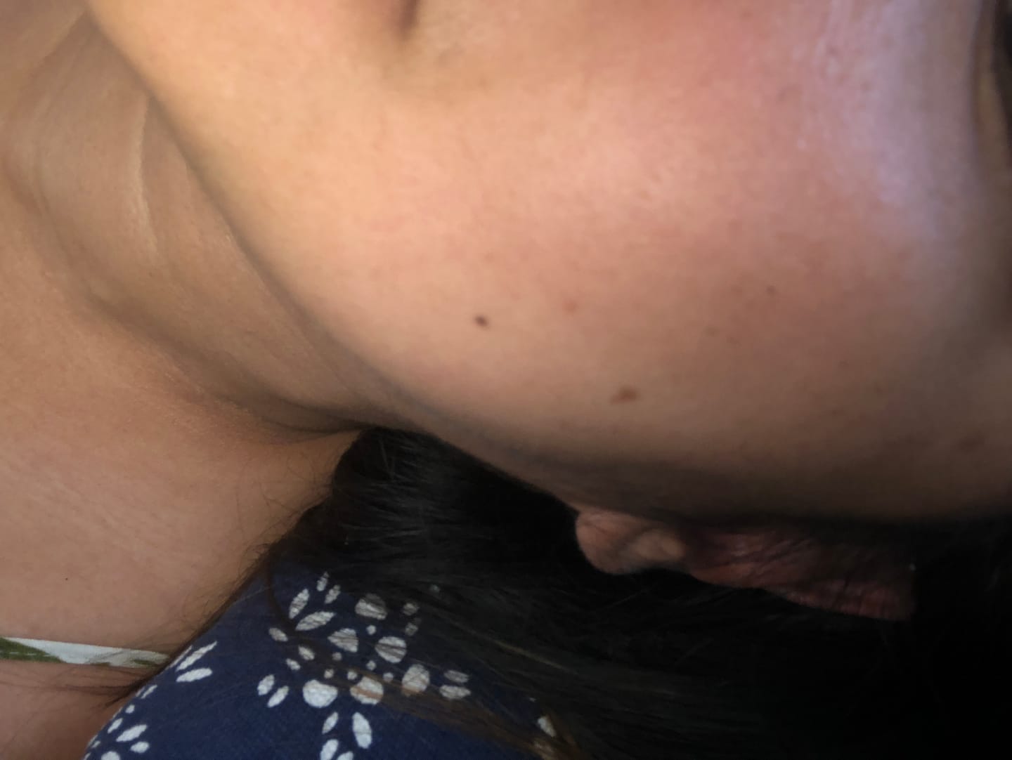 Customer photo review of Purifying Gel Cleanser