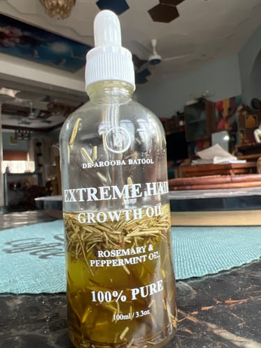 Customer photo review of Rosemary Hair Oil