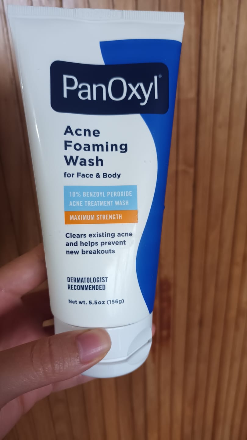 Customer photo review of PanOxyl Maximum Strength Antimicrobial Acne Foaming Wash for Face