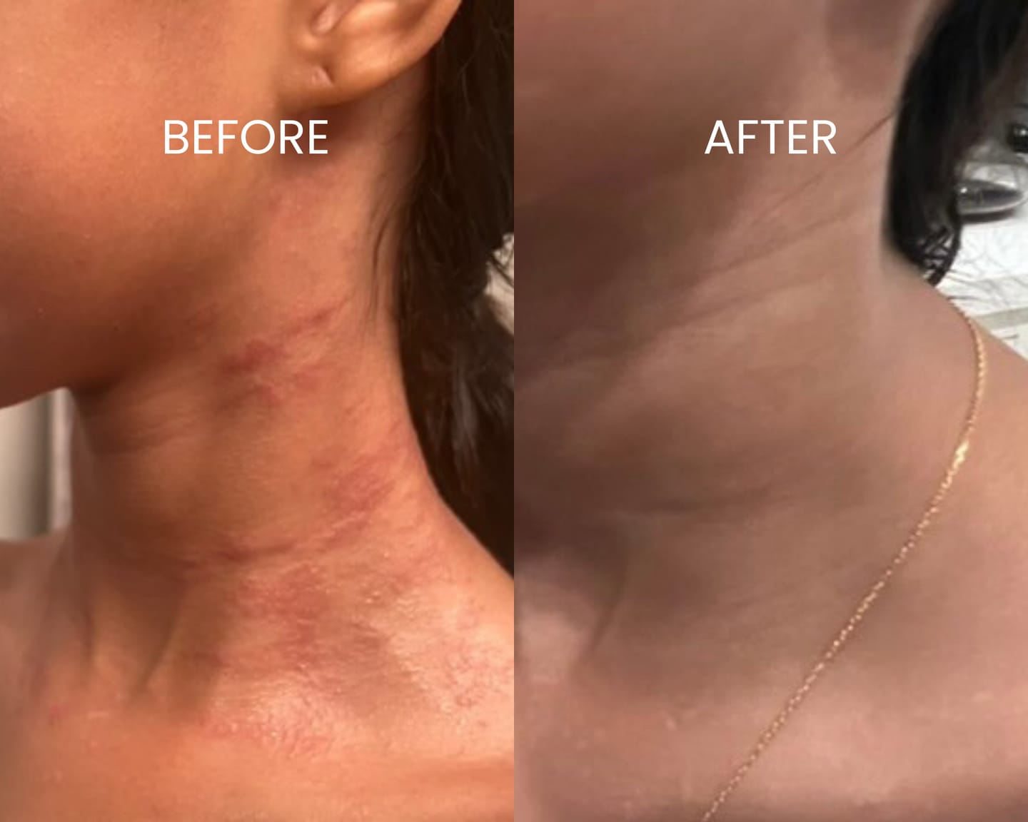 Customer photo review of Children’s Gut Rebalance Kit