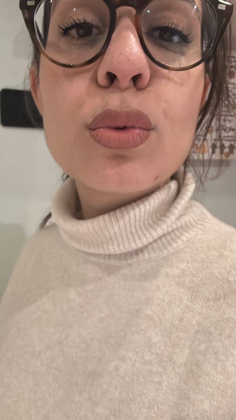 Customer photo review of Lip Over