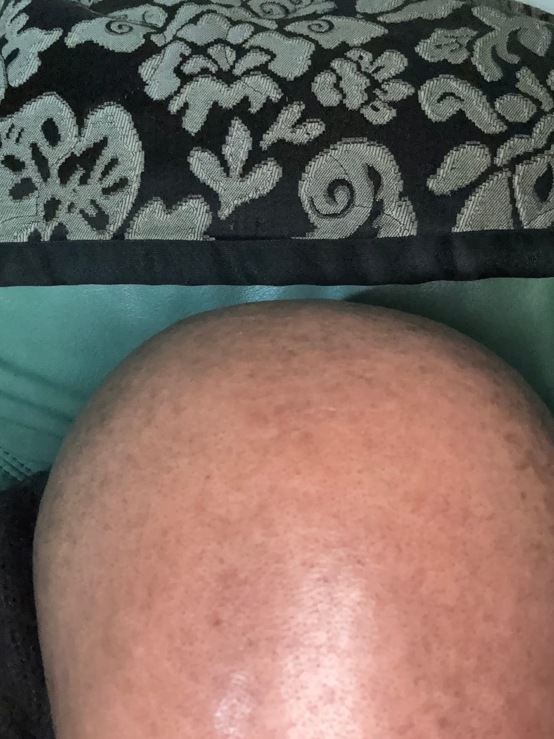 Customer photo review of Trim Pod 2.0