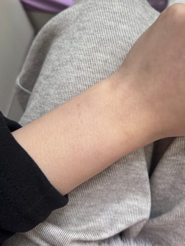 Customer photo review of Ulike Air10 家用脫毛儀買1送10 -Ulike12月IG限時獨家優惠