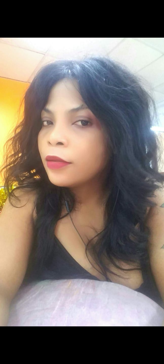 Customer photo review of Fair and White Glutathion Extra Serum Anti-Dark Spot 30ml / 1.01 Fl Oz