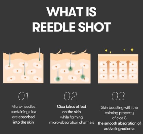 Customer photo review of Reedle Shot 300