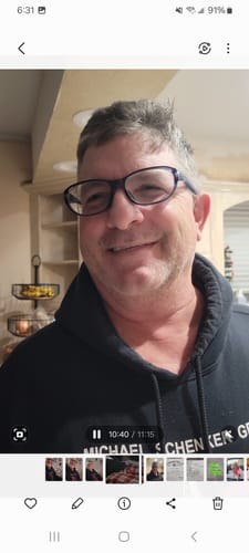 Customer photo review of Pop On Veneers with Impression Kit