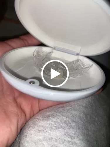 Customer video review of Missing Tooth Retainer, Instant Smile Fix