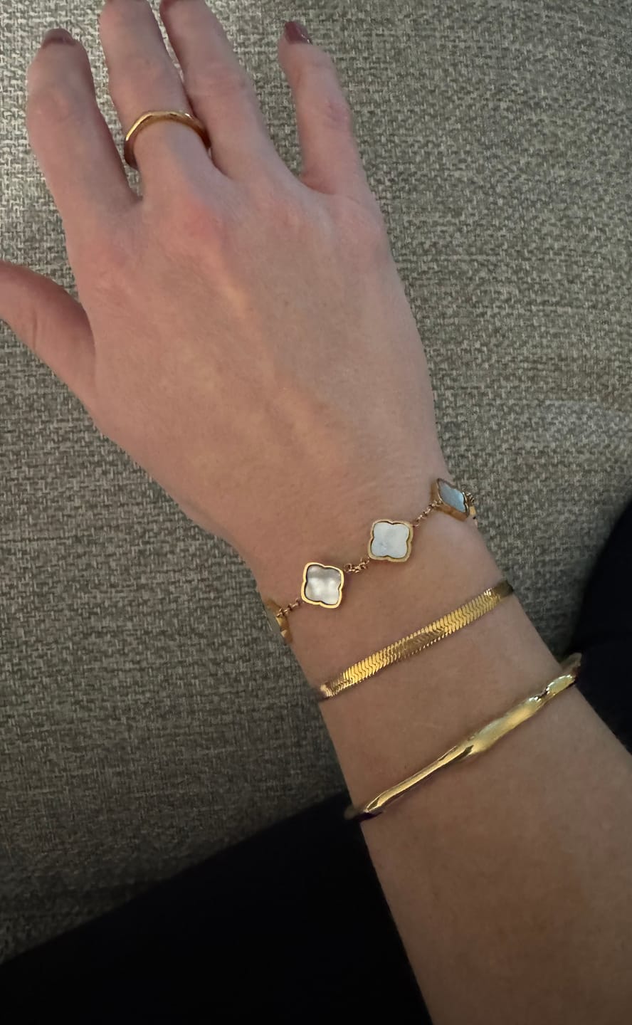Customer photo review of Essentials Bracelet