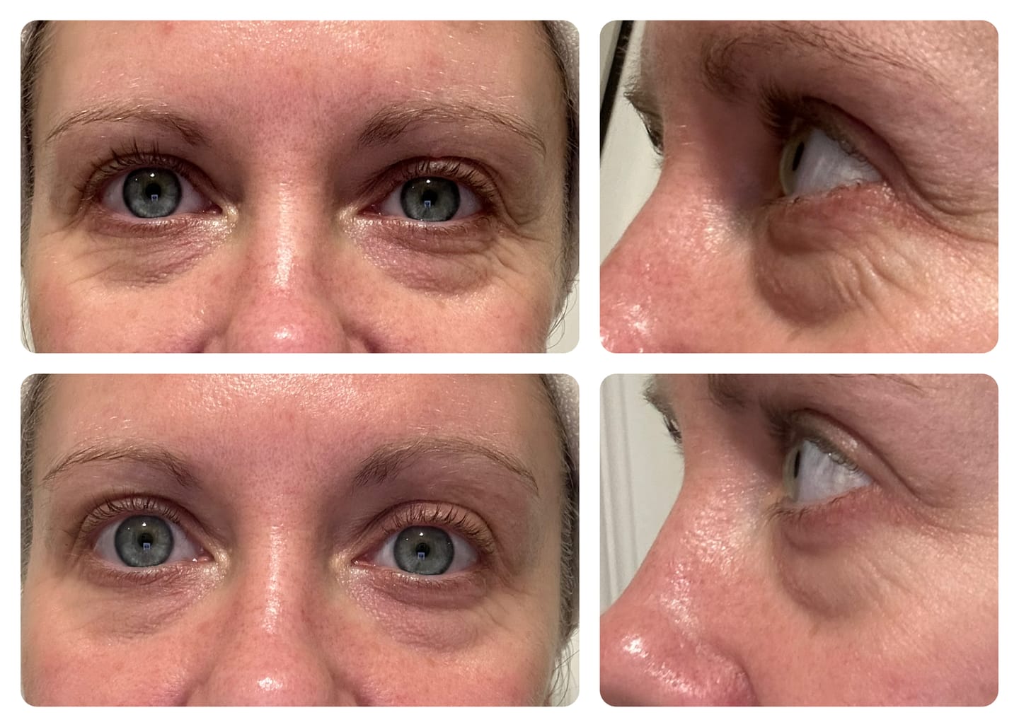 Customer photo review of Anti-Fatigue Eye Mask