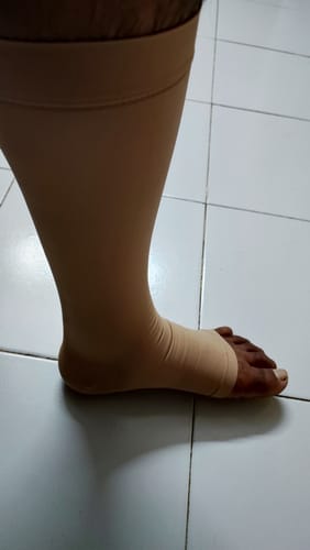 Customer photo review of Medical Compression Stocking - Class 2 Knee Length | Mild Support | Improves Blood Circulation | Swollen | Tired | Aching Legs  (Beige)