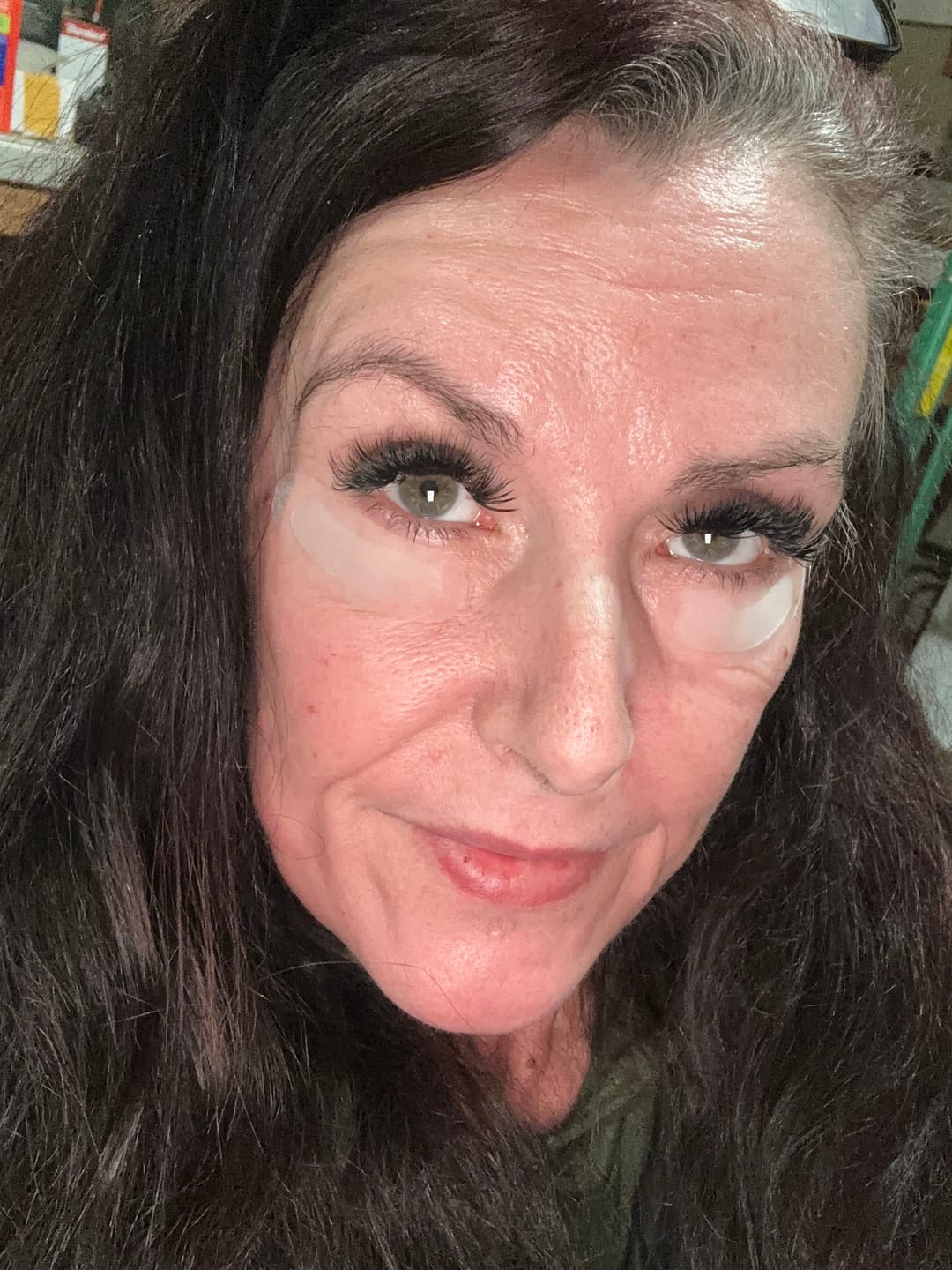 Customer photo review of Glov Serum-Infused Microneedle Eye Patches