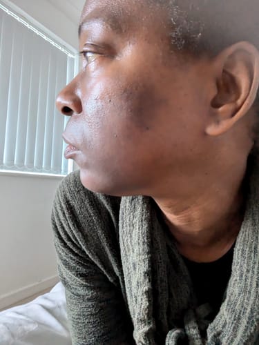 Customer photo review of Turmeric Glow Soap