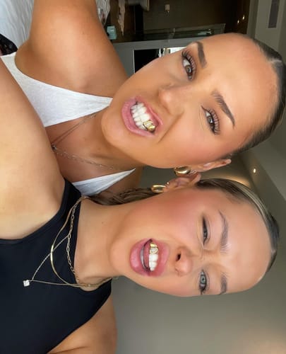 Customer photo review of PRISM (SILVER GRILLZ)