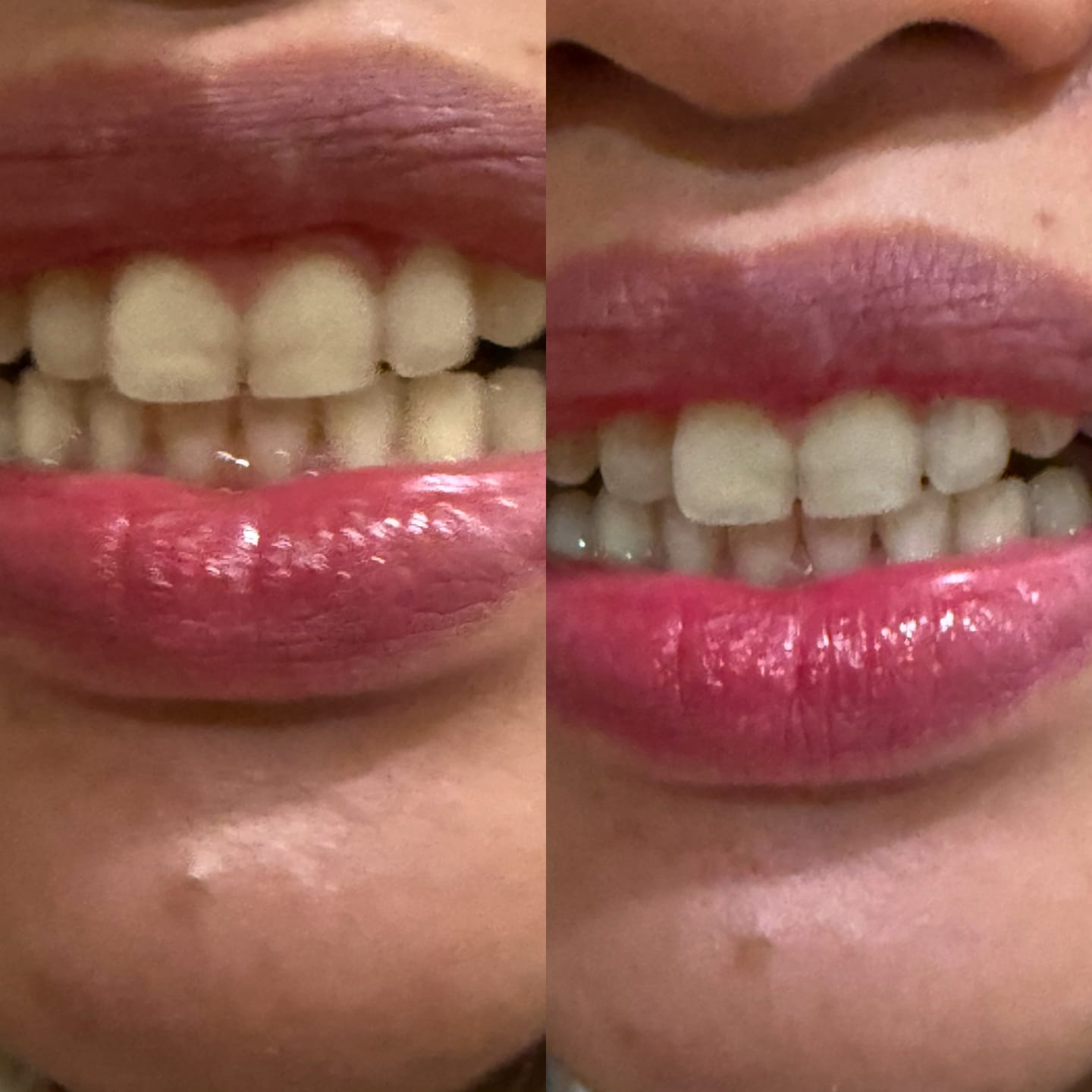 Customer photo review of Whitening & Care Duo